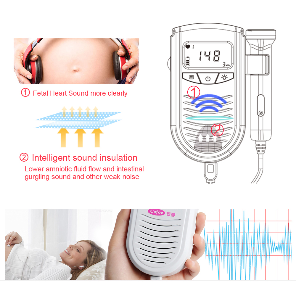 can you hear baby heartbeat at 10 weeks with doppler