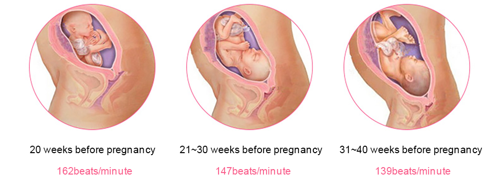Ultrasound Baby Heartbeat Doppler